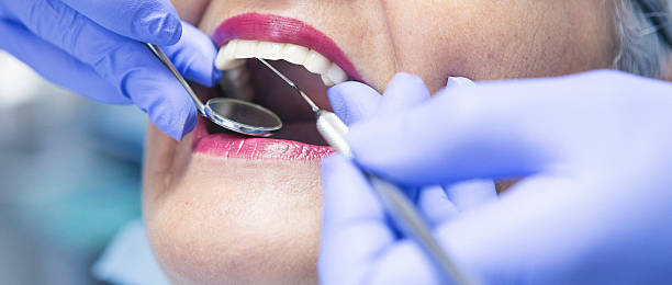 Best Emergency Root Canal Treatment in Arlington, OH